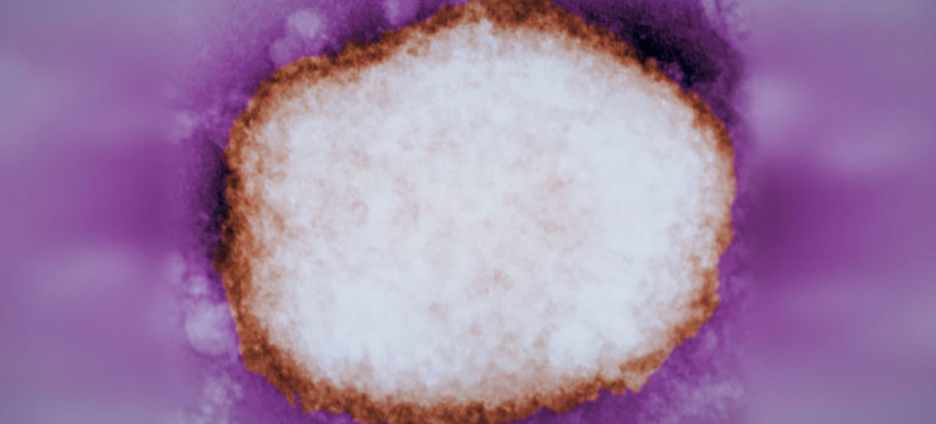 Partícula amplificada del virus de la viruela del simio.